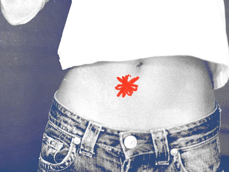 Causes of ulcerative colitis pain and how to treat it