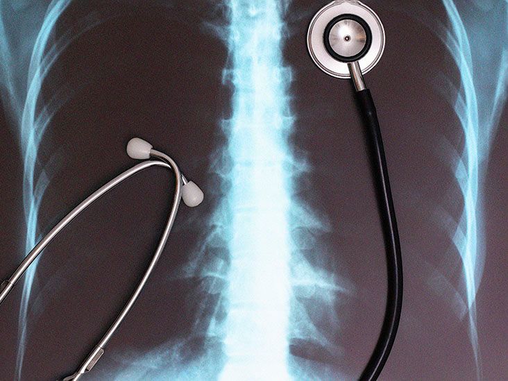 Respiratory retractions Definition, types, and more
