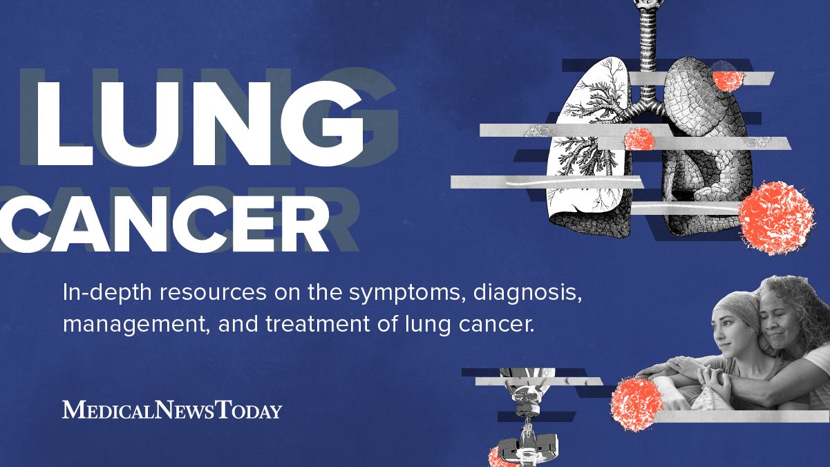 Lung Cancer Diagnosis And Treatment