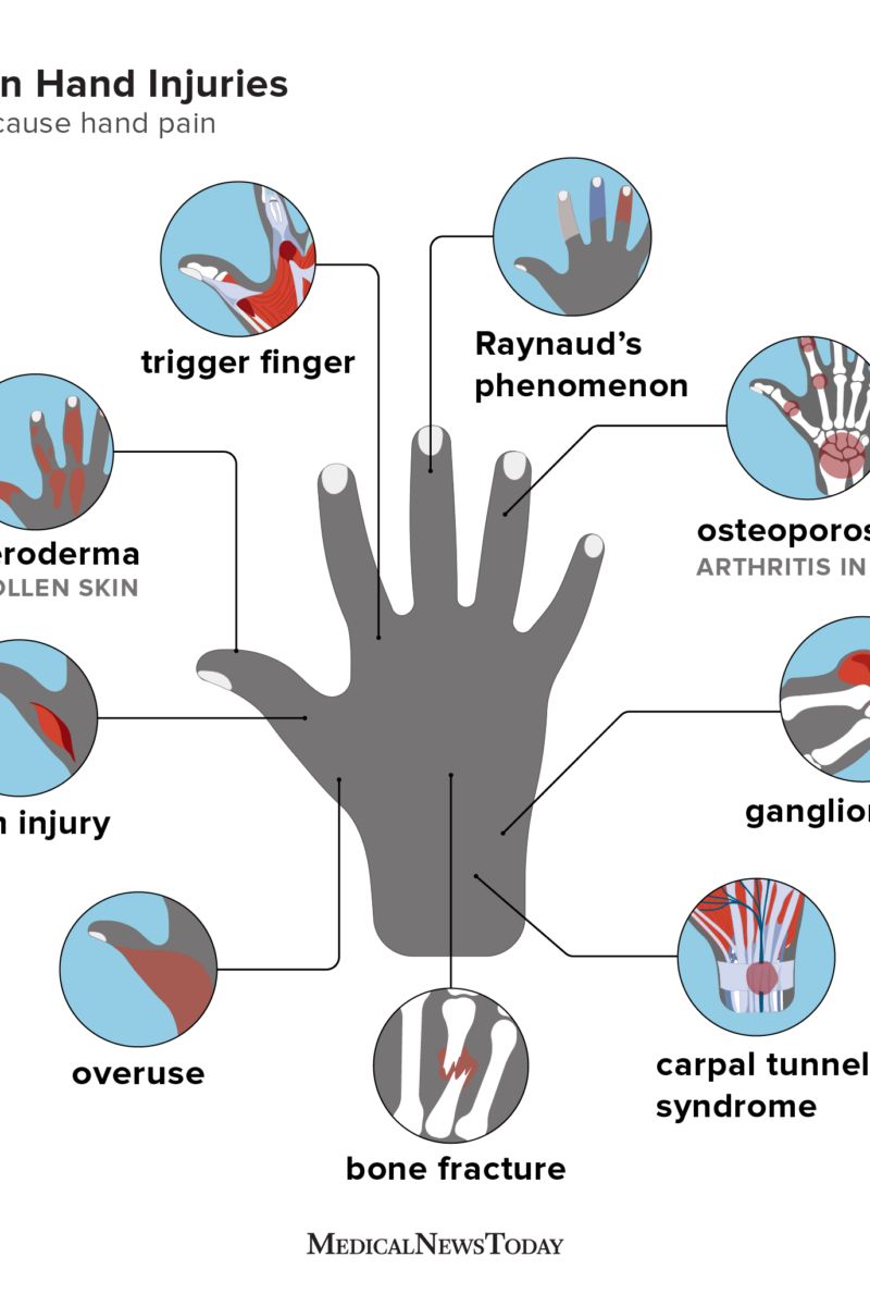 A) Oblique avulsion of the left middle finger pad. The subcutaneous... |  Download Scientific Diagram