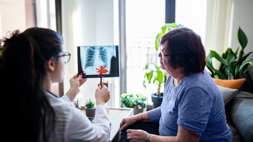 doctor showing patient lung scan