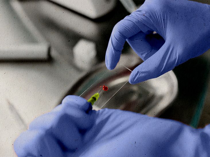 Pancytopenia Symptoms, causes, and treatment