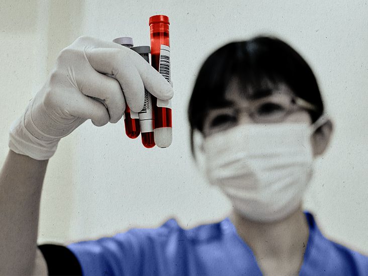 ana-blood-test-purpose-what-to-expect-results-explained-and-more