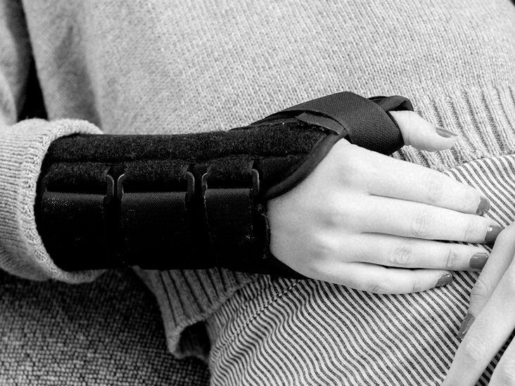 Overdoing it after carpal tunnel surgery: Risks and more