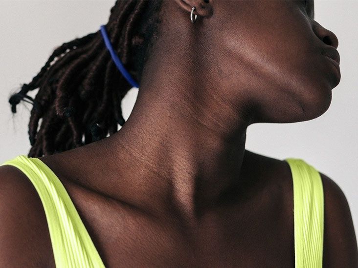 Frozen shoulder and menopause Link and how to treat