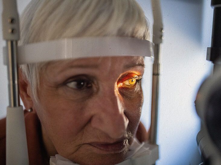 What is the difference between wet and dry macular degeneration?