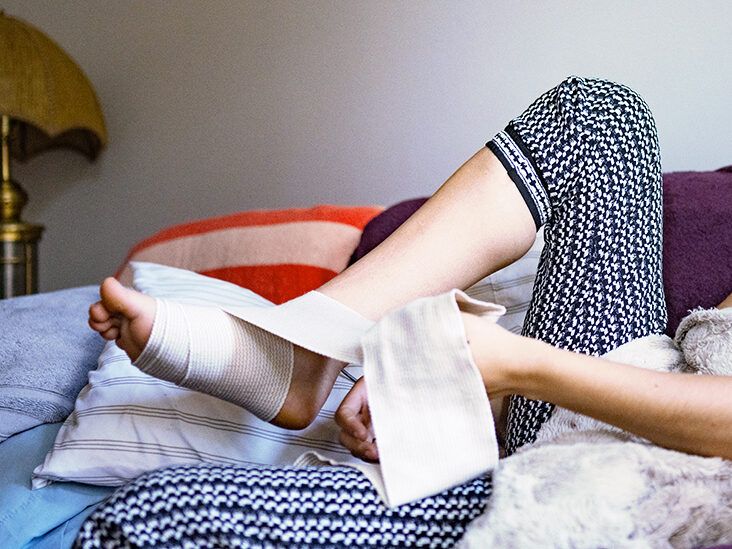 How to heal a sprained ankle: Tips for a fast recovery
