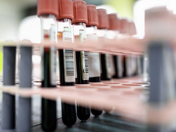 Blood test may predict long-term risk of diabetes and heart disease