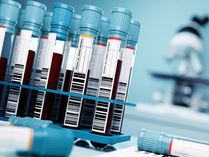 Multiple sclerosis Tests and diagnosis