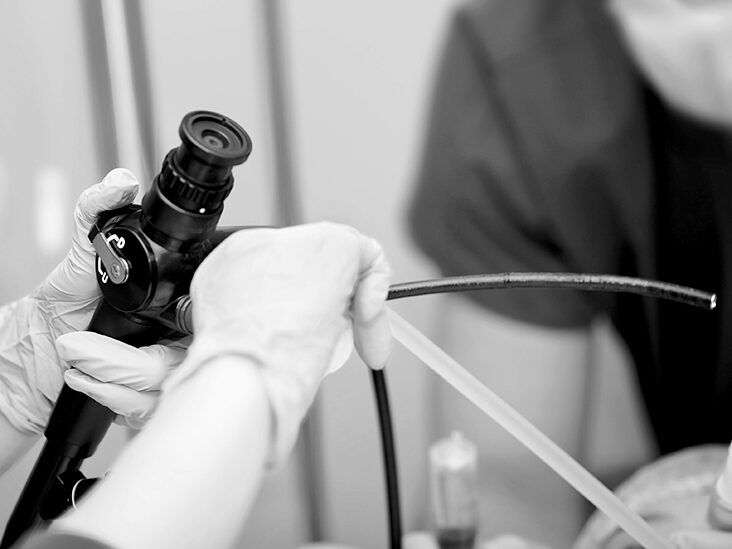 Endoscopy: Types, preparation, procedure & risks