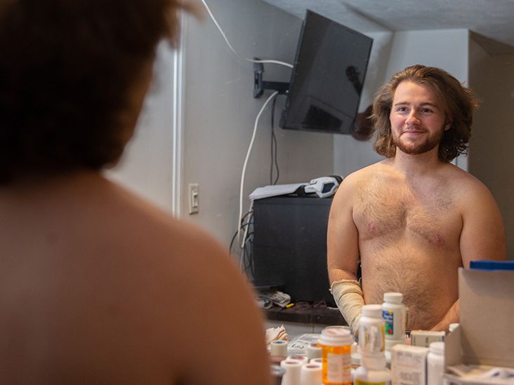 Top surgery Types, prerequisites, cost, recovery, and more