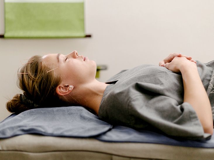 Acupuncture for depression Results, what the research says, and more