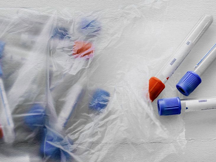 Herpes antibodies Overview, test, symptoms, and more