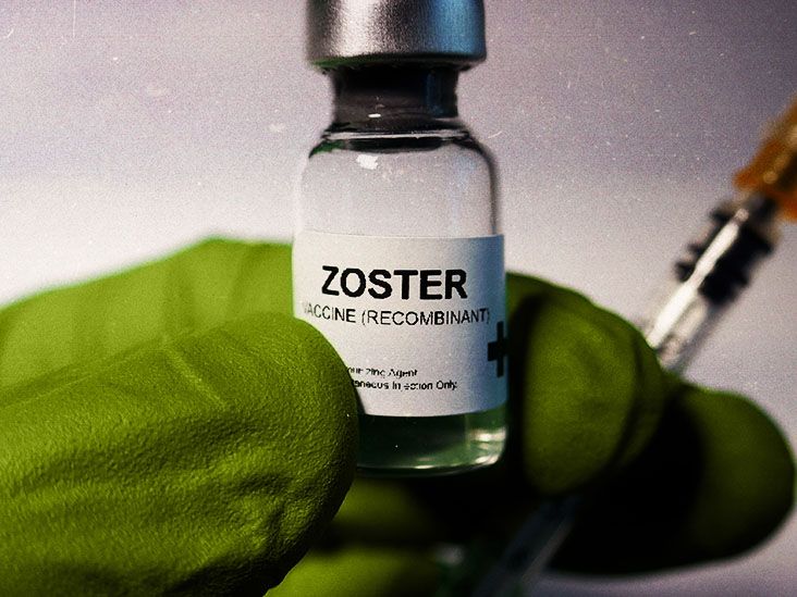 Can you get shingles if you haven't had chickenpox?