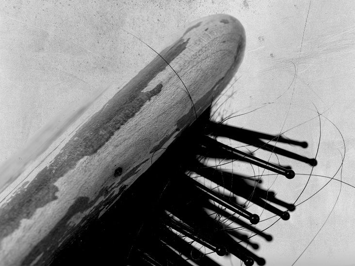 Does psoriatic arthritis cause hair loss? Risks and tips