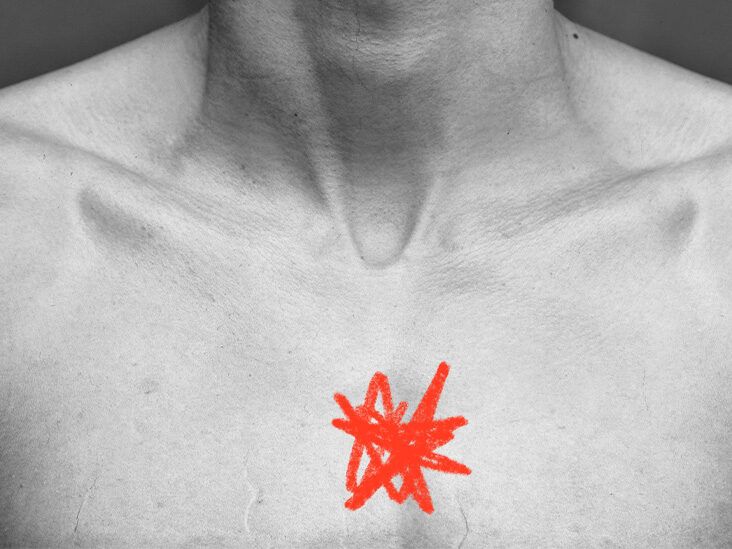 What is sternum pain and what causes it