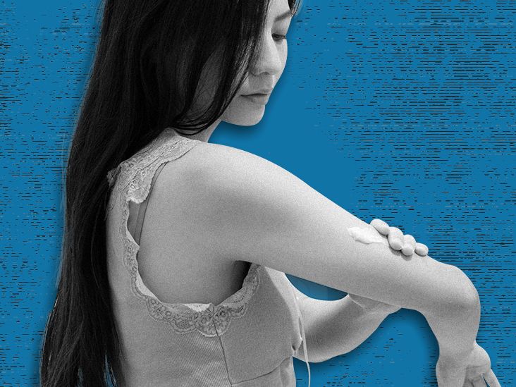 The 8 best lotions for eczema