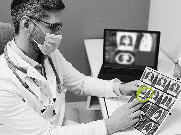 What are the uspstf lung cancer screening guidelines 