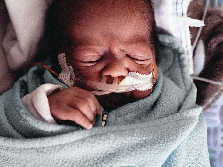 Salmonella Enterocolitis Overview Causes Symptoms Tre vrogue.co