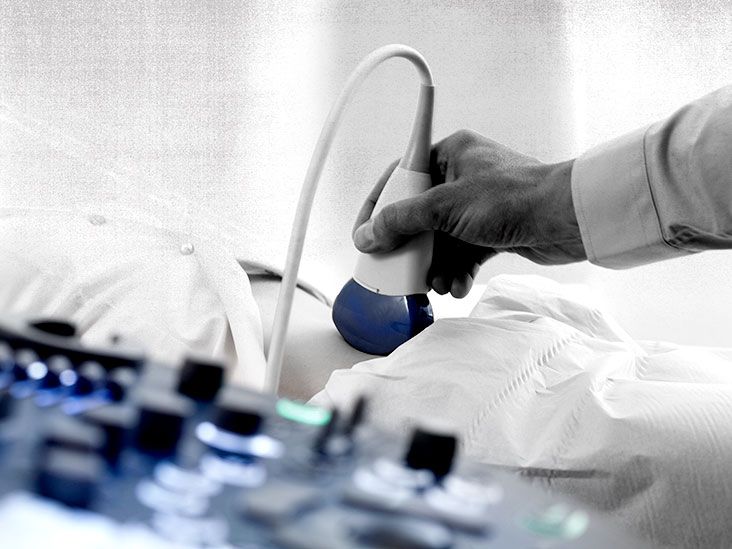 Ovarian tumor size Does it matter, cancer stage, and treatment