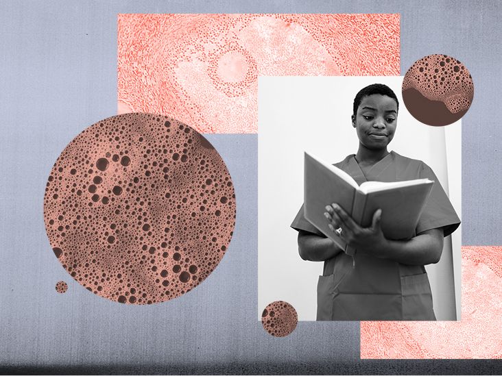 AMH levels What they mean, how to test, and modify