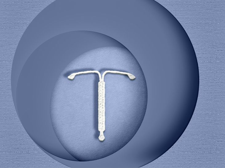 do-iuds-cause-pelvic-inflammatory-disease-what-to-know