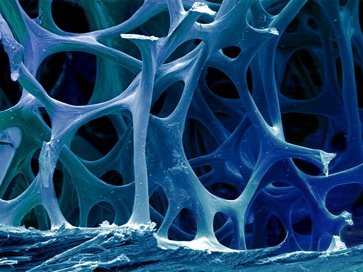 high-blood-pressure-linked-to-bone-loss-and-aging-mouse-study-finds