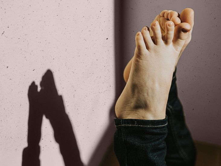 Brittle bone disease Types, symptoms, treatment, and more