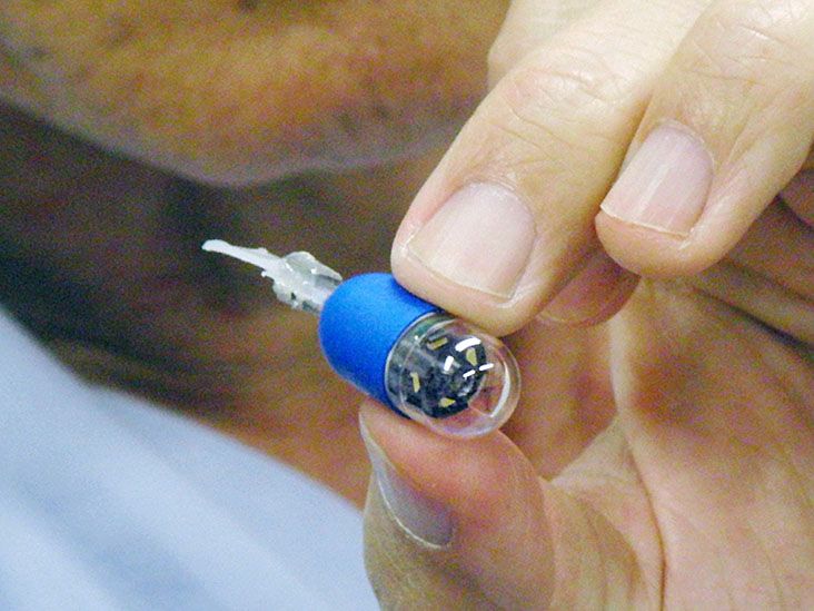 Capsule endoscopy What to expect, results, and more