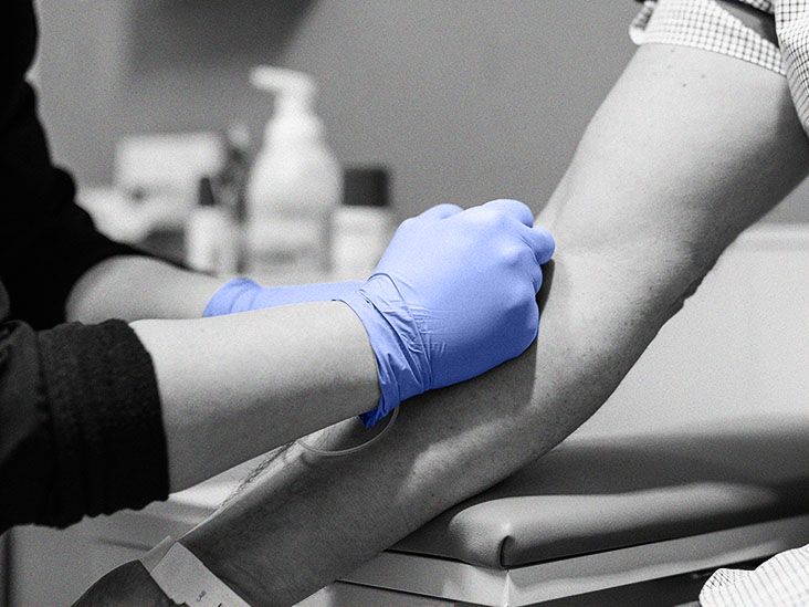 Blood tests for psoriatic arthritis Types, results, and next steps