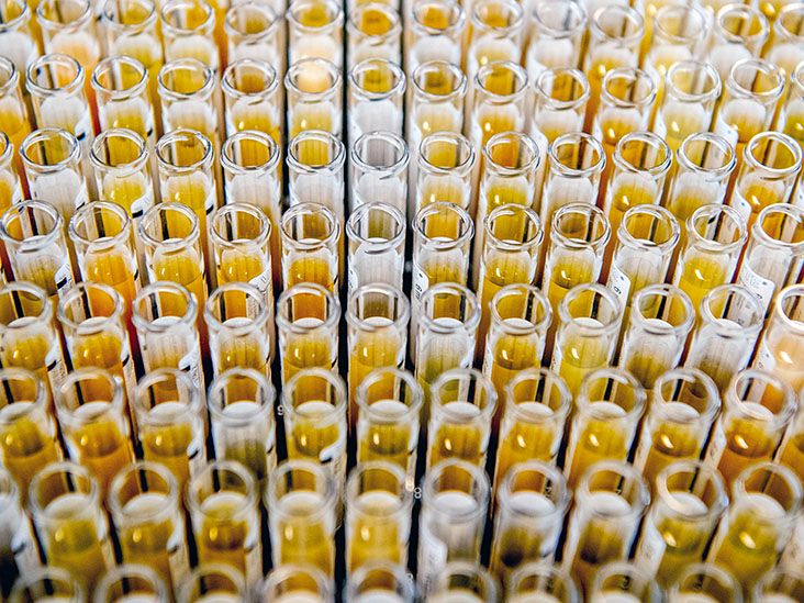 Blood test for long COVID Could blood proteins predict risk?