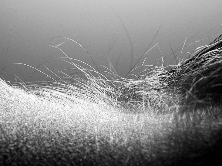 Neck arthritis Symptoms, types, treatment, and more