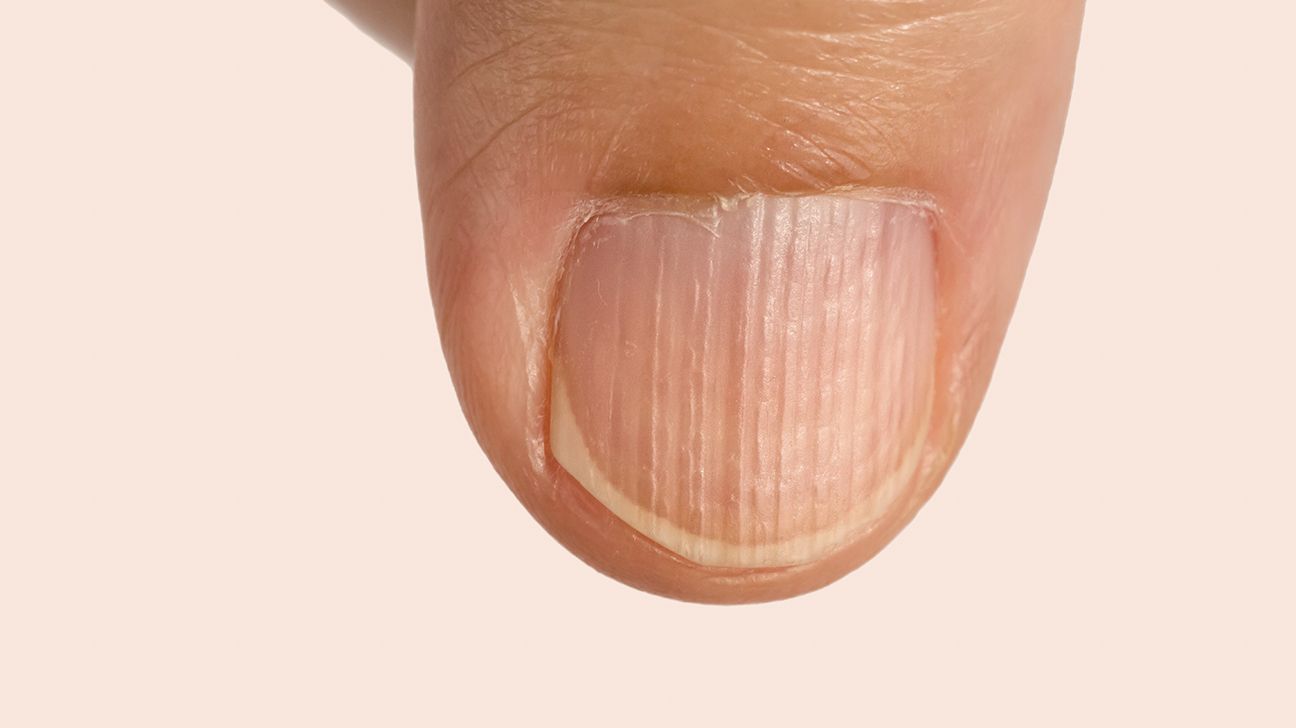 7 fingernail problems not to ignore - Mayo Clinic