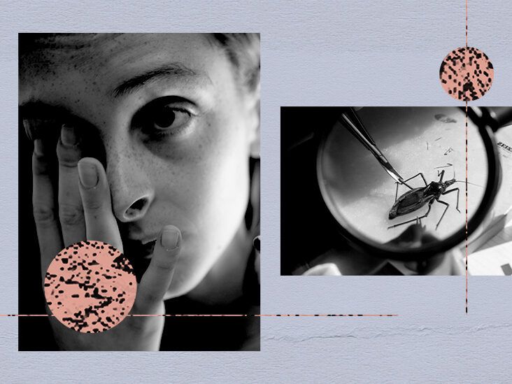 Chagas disease symptoms collage thumb