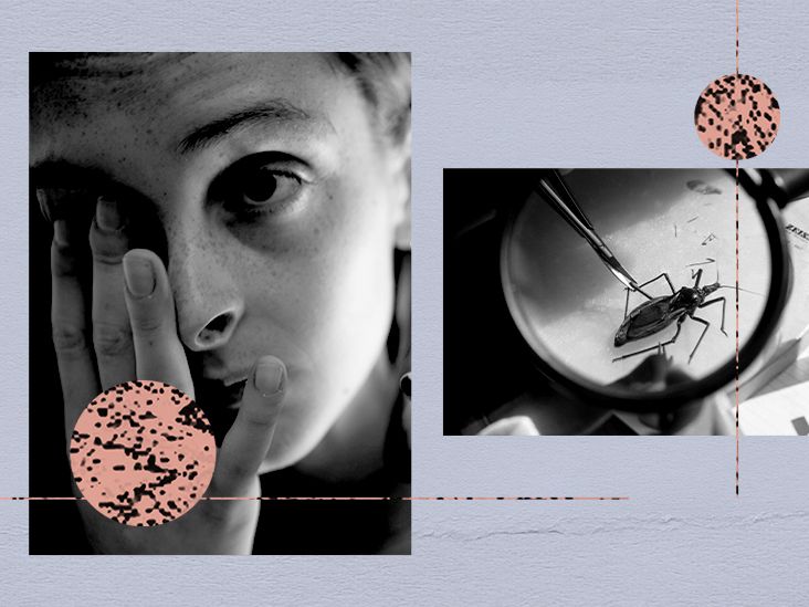 Chagas Disease Symptoms 2854