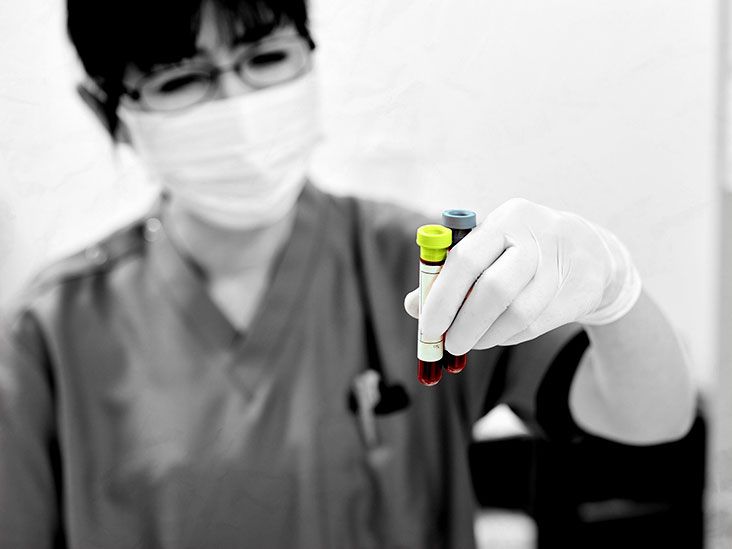 What is the Ddimer normal range?