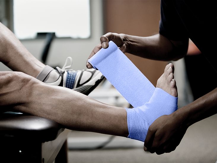 Ankle fusion recovery: Timeline, physical therapy, complications