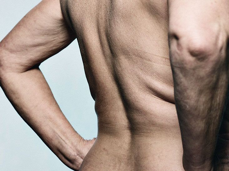 9 Lower Back Pain Relief Self-Care Remedies for INSTANT RELIEF