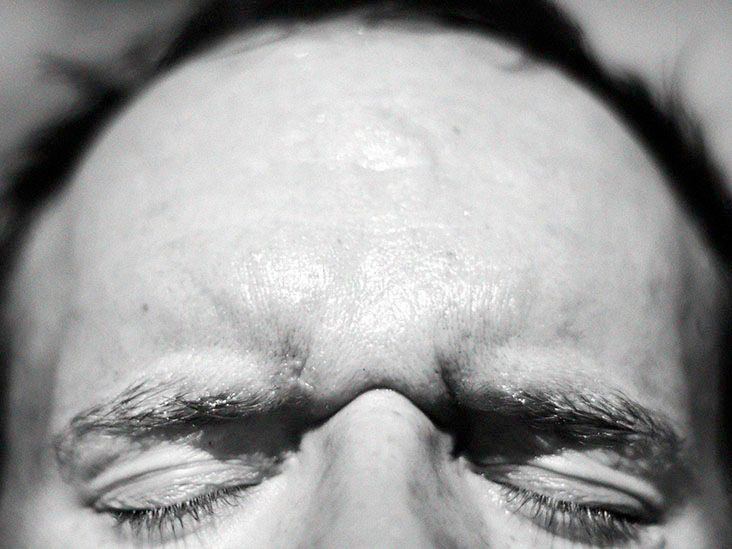 Forehead veins Causes of bulging and treatment