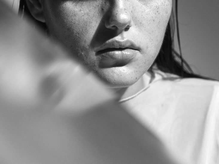 How Is Schizophrenia Diagnosed