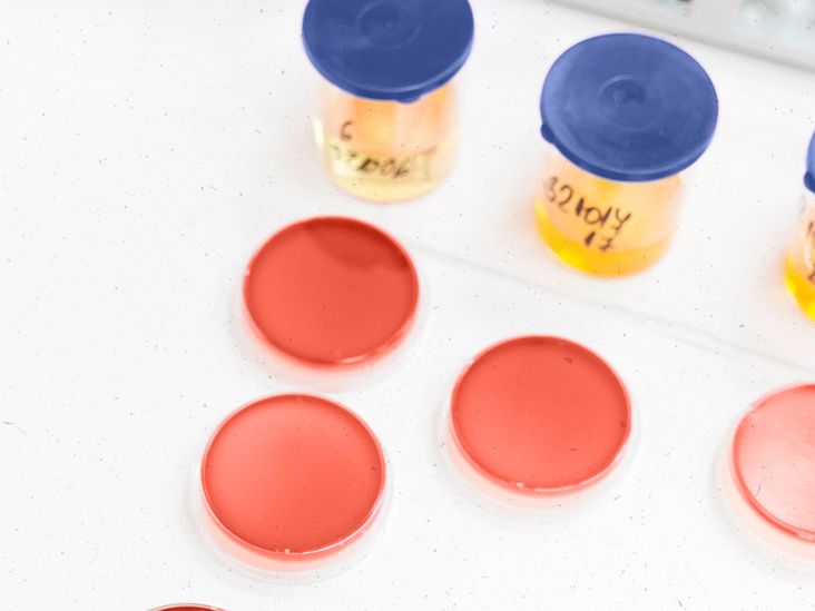 Early cancer detection: Noninvasive test spots 14 cancer types