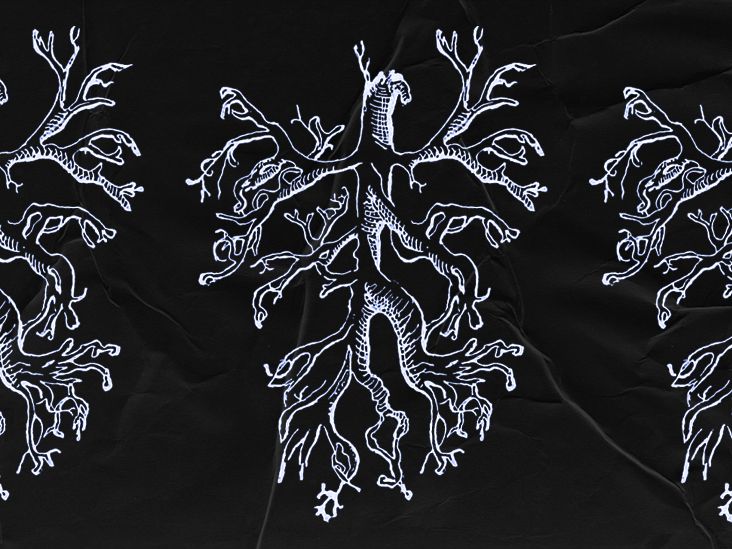 形成性気管支炎はどのように診断されますか?