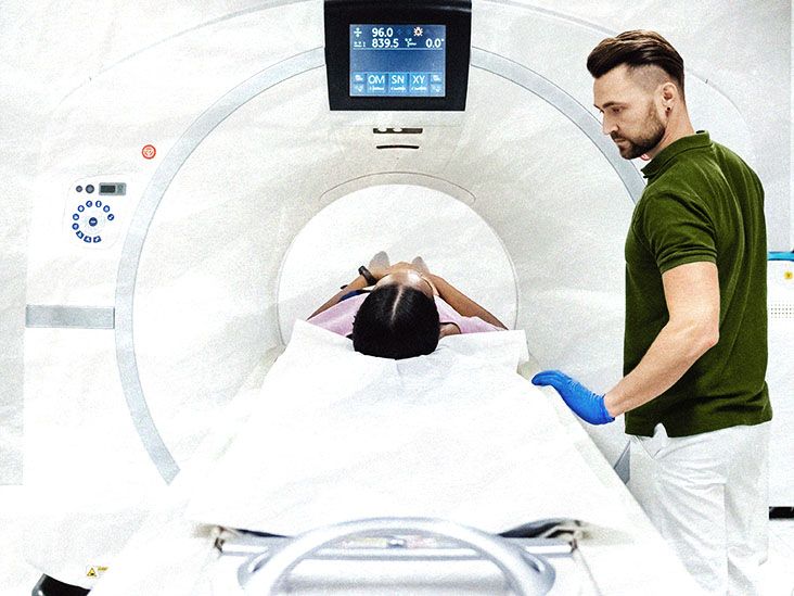 CT scans for seizures: Uses, what happens and more