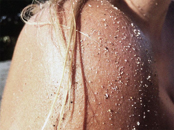 Chafing vs. Sweat Rash: Understanding the Differences