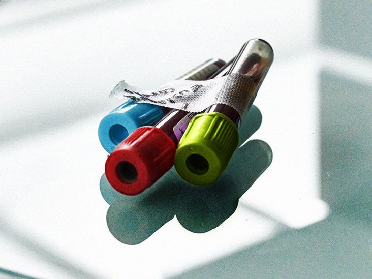 Non-Hodgkin's lymphoma: Blood tests and results