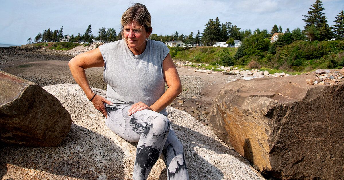 The link between ulcerative colitis and avascular necrosis The link between ulcerative colitis and avascular necrosis