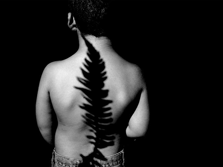 Bone cancer in children what to know