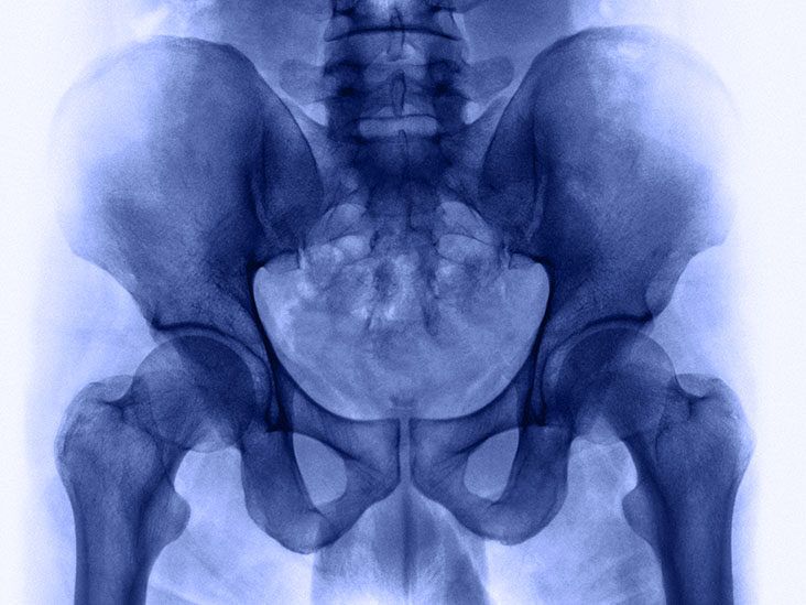 What are the symptoms of tailbone cancer?