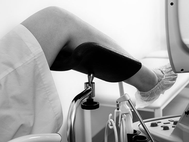 IUD displacement Signs, how to check, and next steps