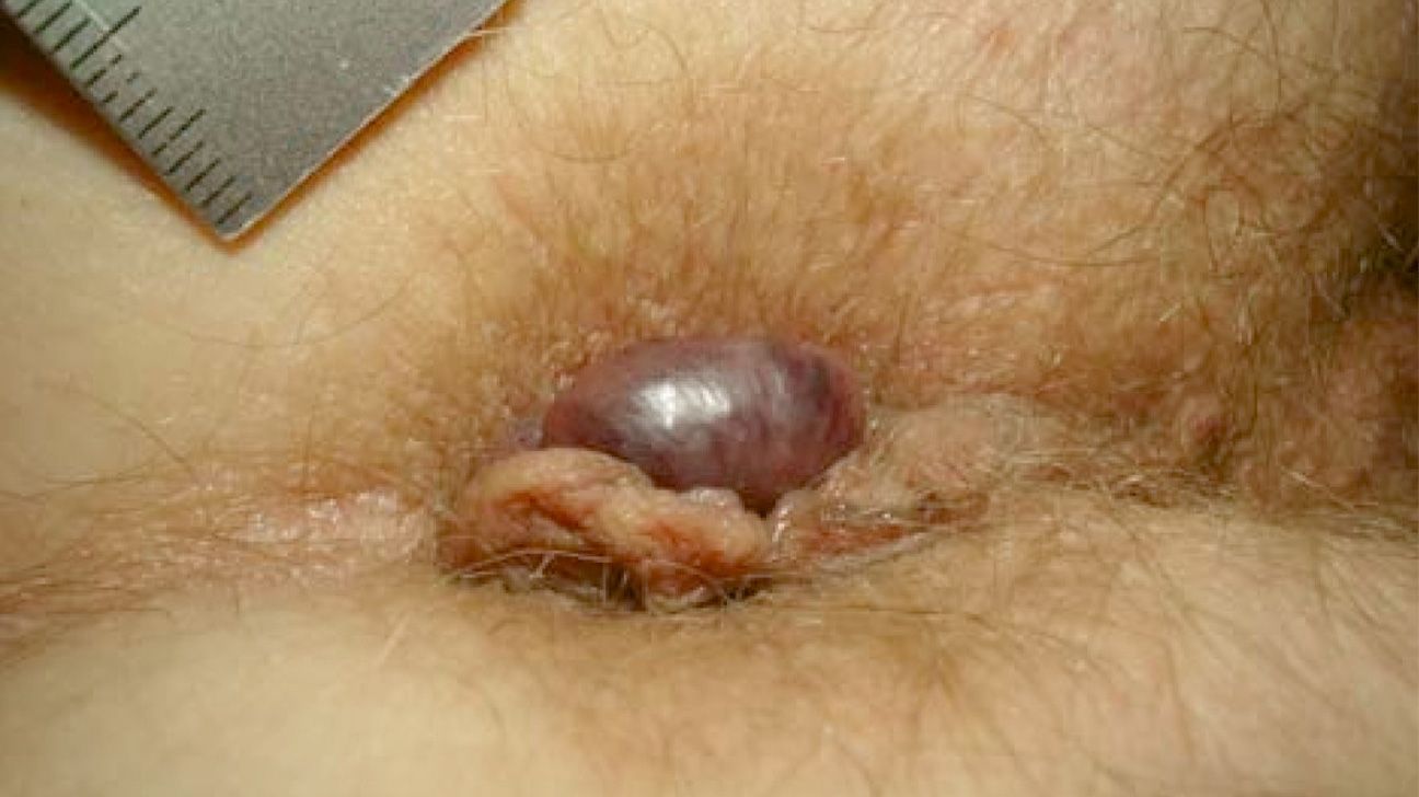 Porno yulduzlar katta xorozlar tomonidan becerdin va ularning ichida cum olish Yetuk jinsiy aloqa